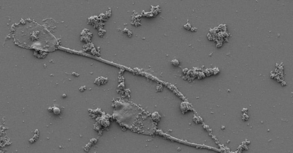 Scientists Are Turning Sperm Cells into Trackable Microbots