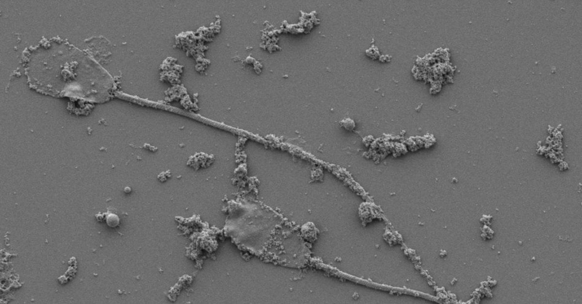 AI Generated Spermbots: Scientists Shock the World with Remote-Controlled Sperm!